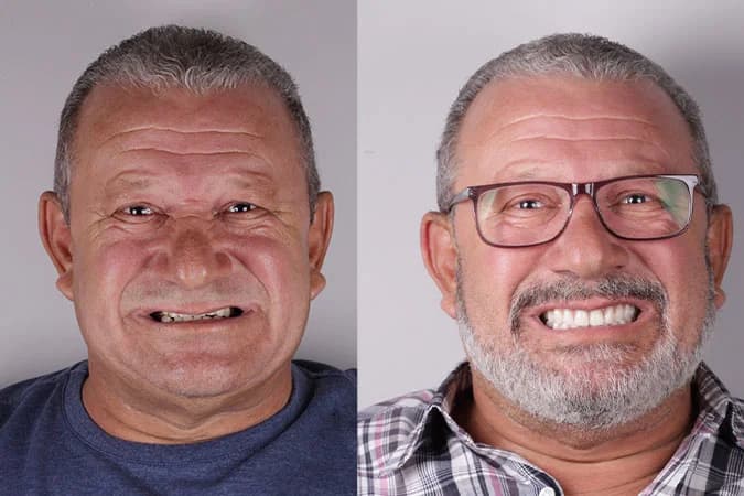Caso de transformação 1 — antes e depois