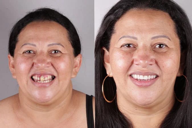 Caso de transformação 2 — antes e depois