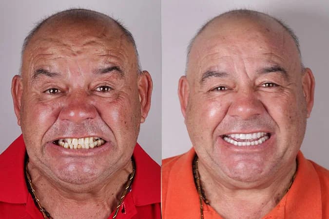 Caso de transformação 3 — antes e depois