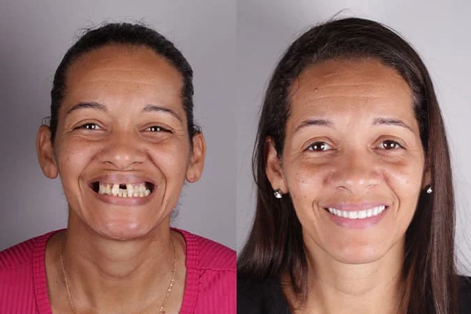 Caso de transformação 4 — antes e depois
