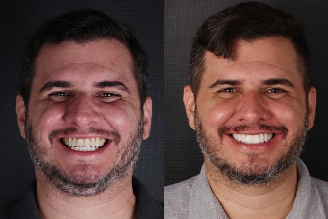 Caso de transformação 5 — antes e depois